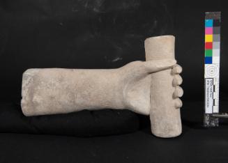 Arm