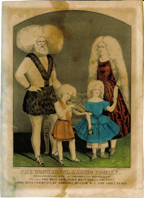 Albino family with two children from Madagascar.