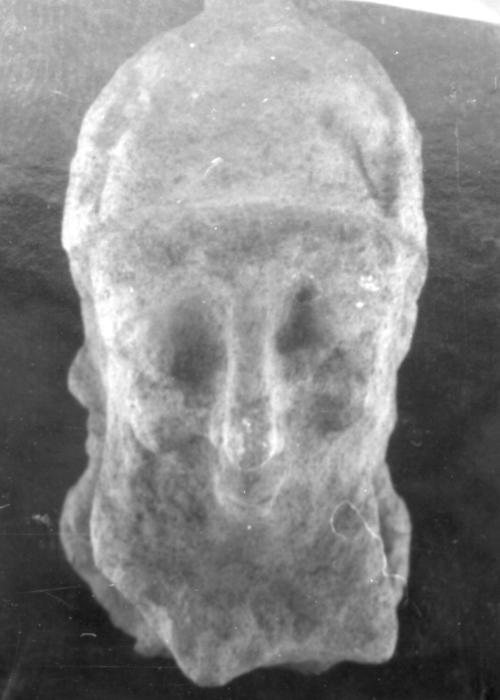 Head, male
