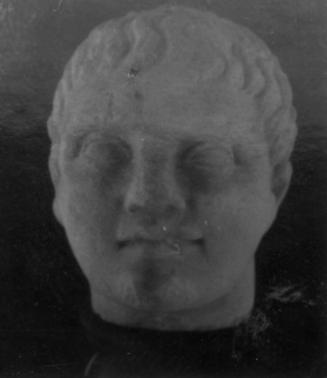 Head, male