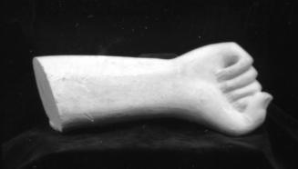 Arm