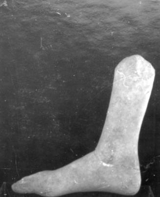 Lower Leg and Foot