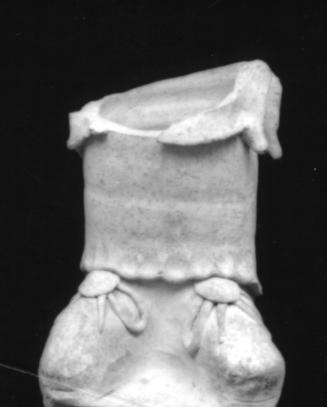 Lower legs and feet