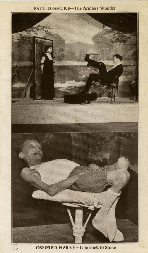 Ripley's Believe It or Not: Paul Desmuke and Ossified Harry