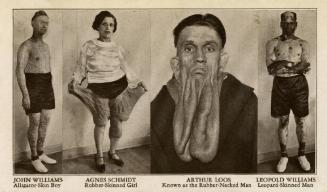 Ripley's Believe It or Not: John Williams, Agnes Schmidt, Arthur Loos, Leopold Williams