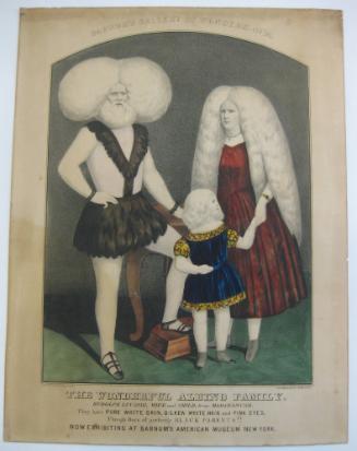 The Wonderful Albino Family