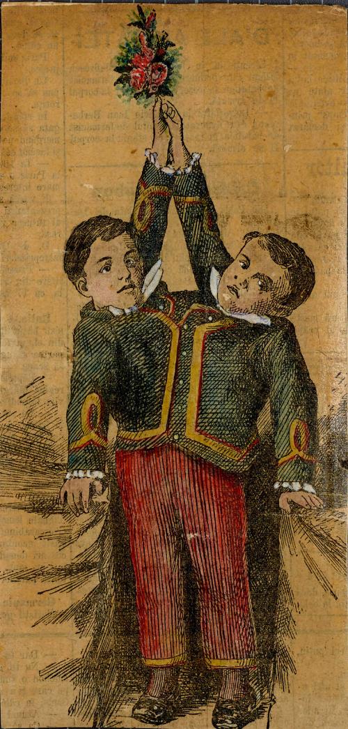 Siamese twin male children with 2 heads