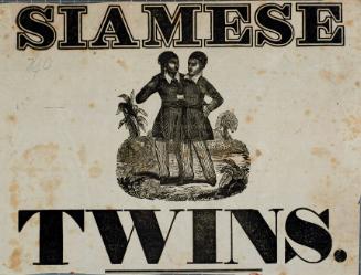 Siamese Twins