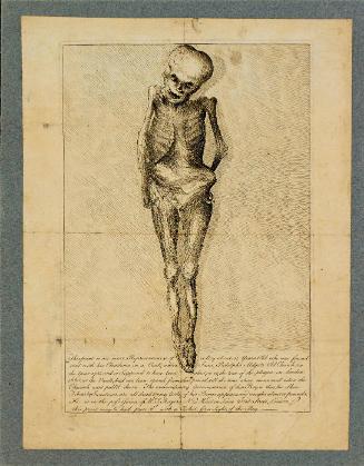 Mummified Boy