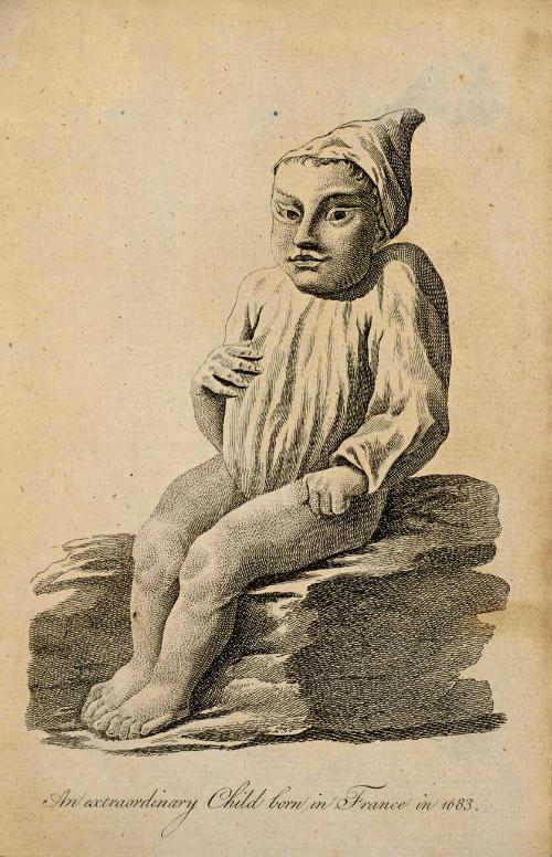 An extraodinary child born in France in 1683